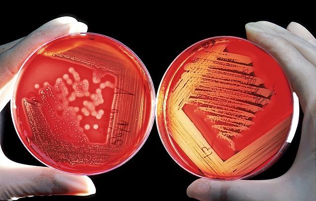 Polysacharidy:​ jaký je rozdíl mezi komplexními a jednoduchými sacharidy?